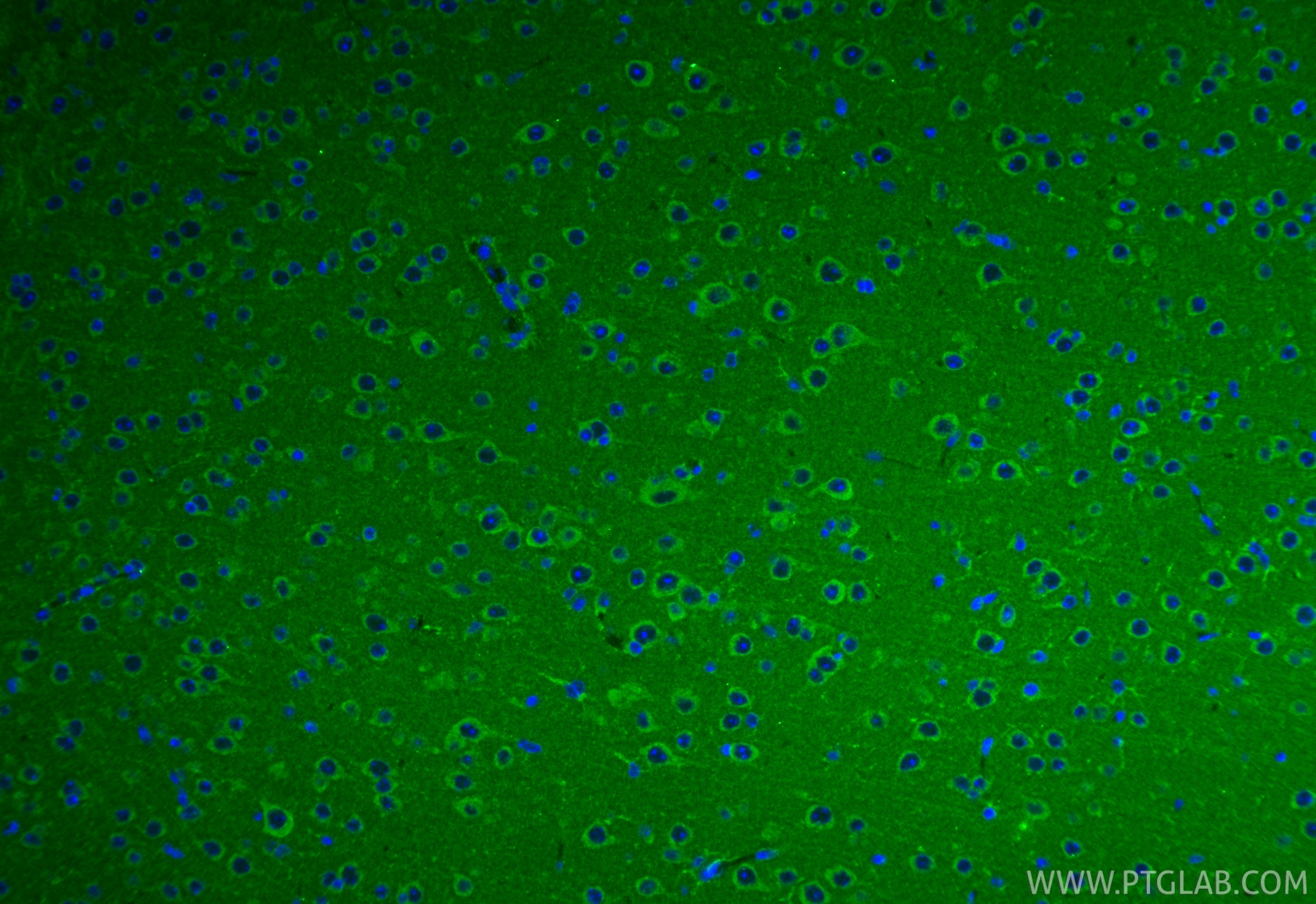 IF Staining of mouse brain using 25484-1-AP Immunofluorescence (IF) / fluorescent staining of mouse brain tissue using ACSF3 Polyclonal antibody (25484-1-AP)