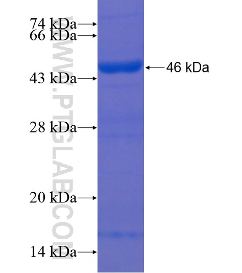 ACSF3 fusion protein Ag21979 SDS-PAGE