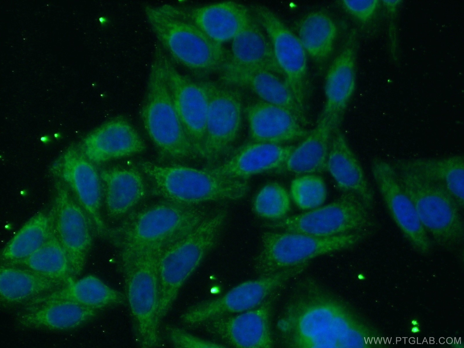 Immunofluorescence (IF) / fluorescent staining of HepG2 cells using ACSL1 Polyclonal antibody (13989-1-AP)