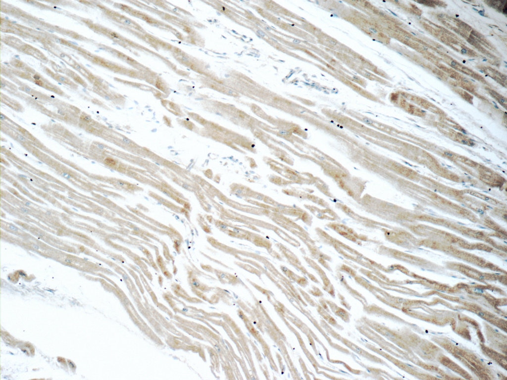IHC staining of human heart using 13989-1-AP