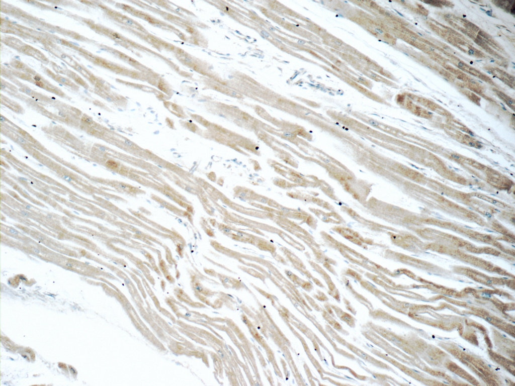 Immunohistochemistry (IHC) staining of human heart tissue using ACSL1 Polyclonal antibody (13989-1-AP)