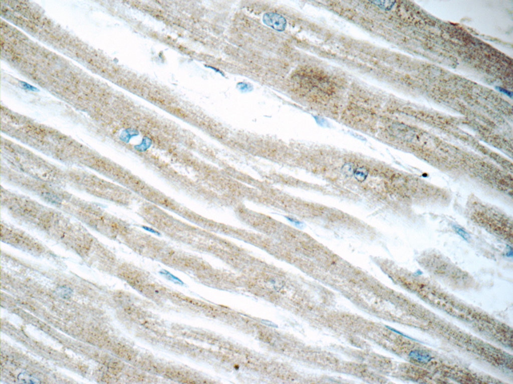Immunohistochemistry (IHC) staining of human heart tissue using ACSL1 Polyclonal antibody (13989-1-AP)