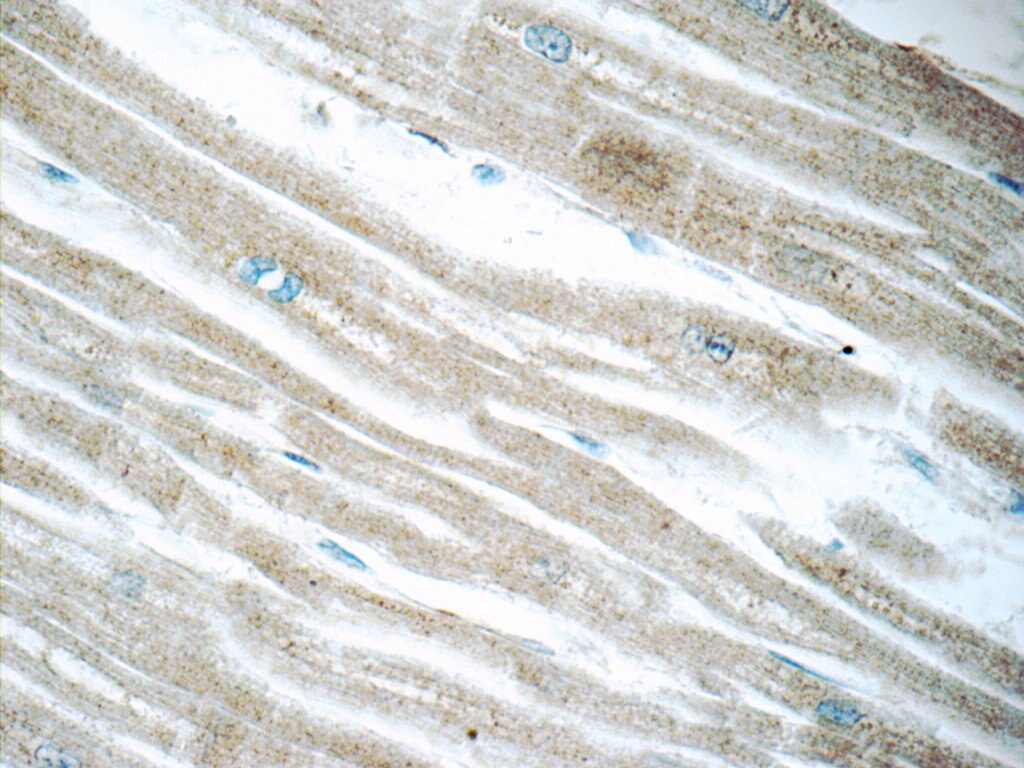 Immunohistochemistry (IHC) staining of human heart tissue using ACSL1 Polyclonal antibody (13989-1-AP)