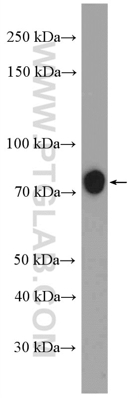 Western Blot (WB) analysis of mouse cerebellum tissue using ACSL1 Polyclonal antibody (13989-1-AP)