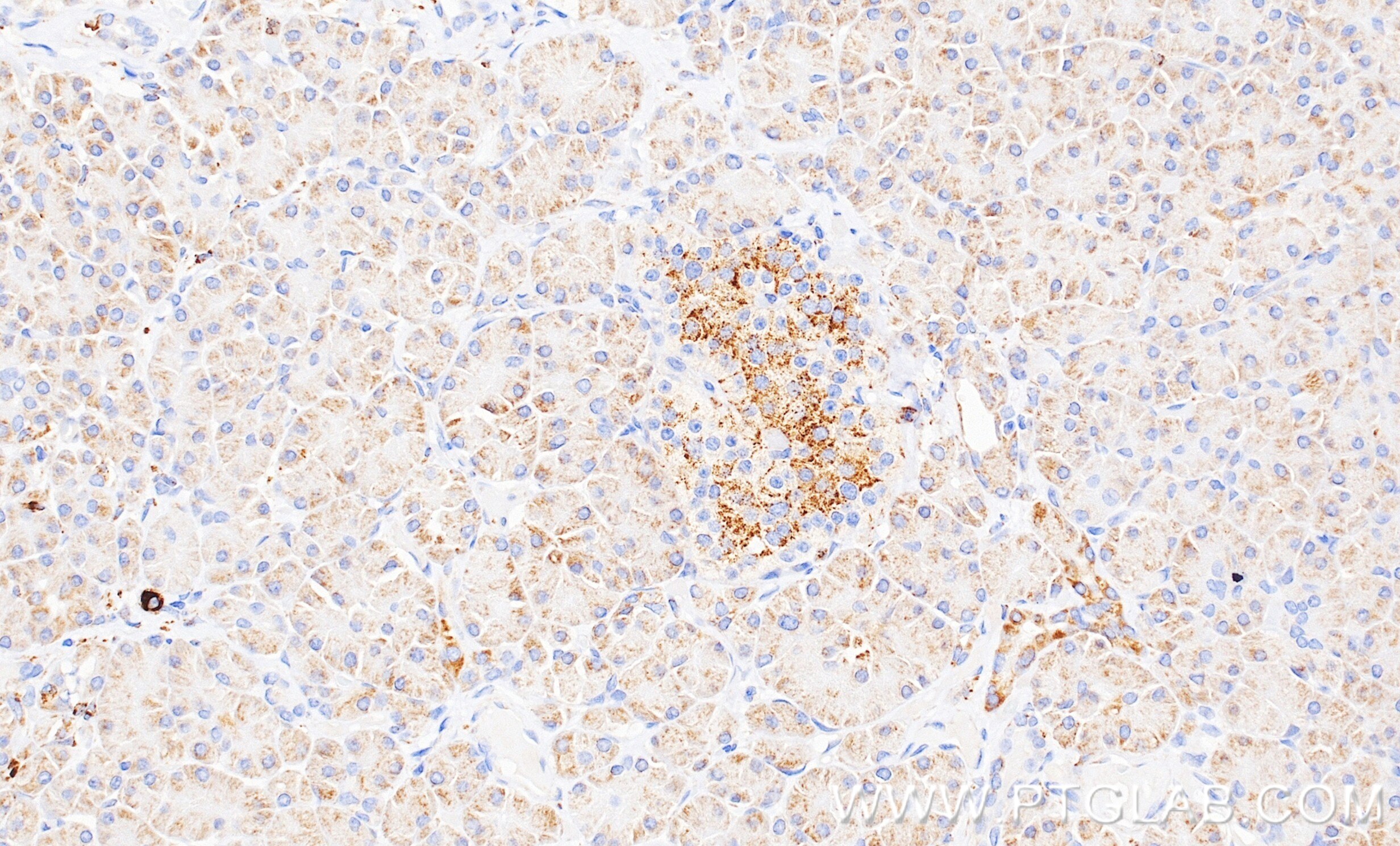 IHC staining of human pancreas using 87427-2-RR (same clone as 87427-2-PBS) Immunohistochemistry (IHC) staining of human pancreas tissue using ACSL1 Recombinant monoclonal antibody (87427-2-RR)