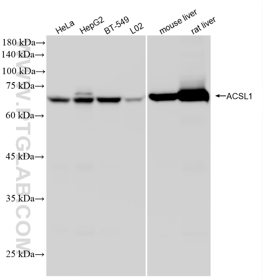 WB analysis using 87427-2-RR (same clone as 87427-2-PBS) Western Blot (WB) analysis of various lysates using ACSL1 Recombinant monoclonal antibody (87427-2-RR)