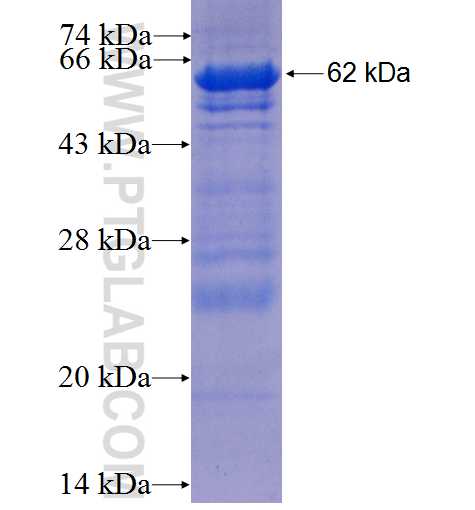 ACSL1 fusion protein Ag5059 SDS-PAGE