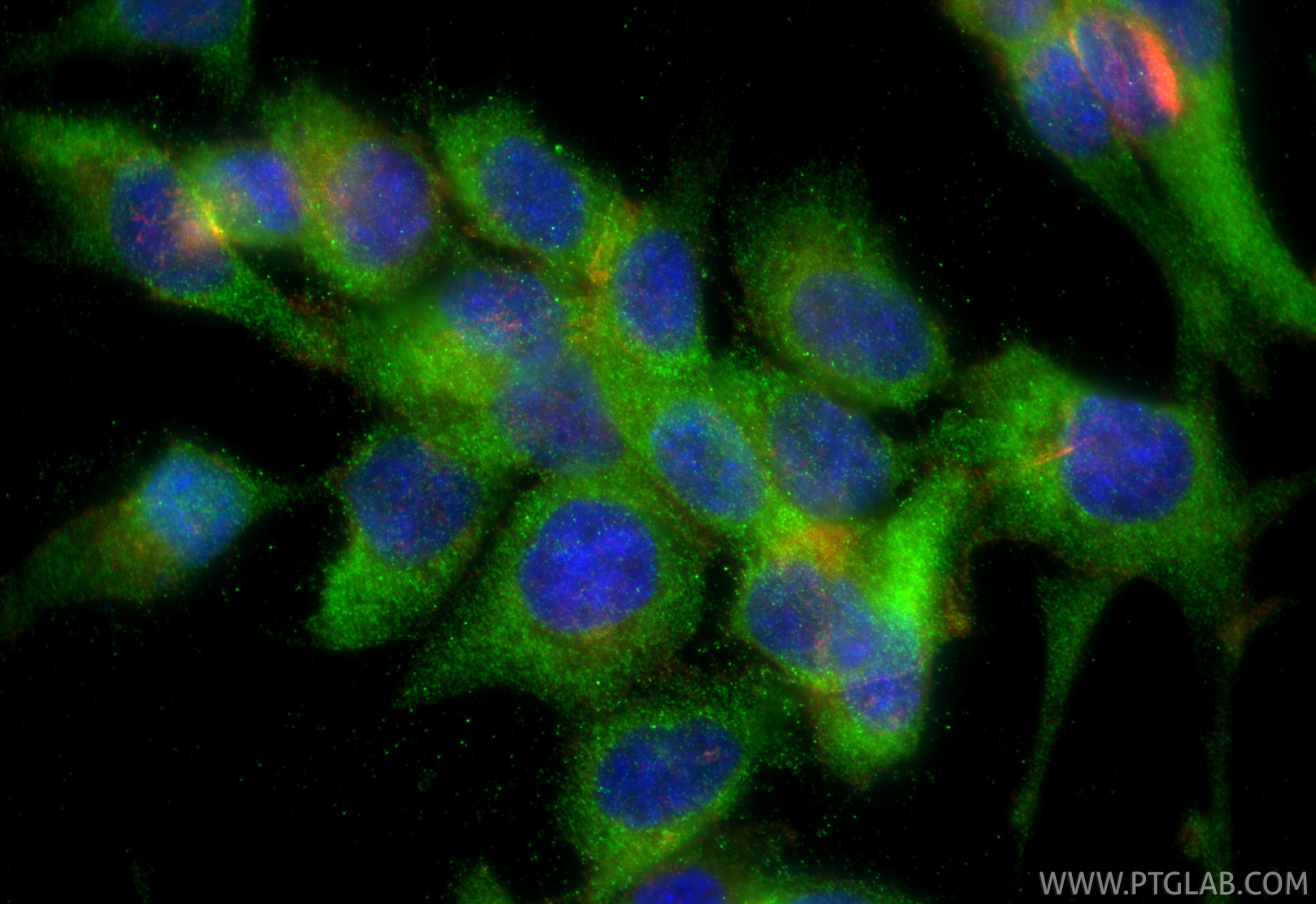 Immunofluorescence (IF) / fluorescent staining of HCT 116 cells using ACSL3 Polyclonal antibody (20710-1-AP)