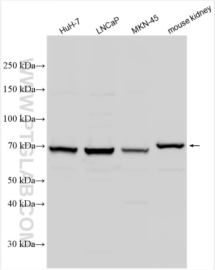 Western Blot (WB) analysis of various lysates using ACSL3 Polyclonal antibody (30214-1-AP)