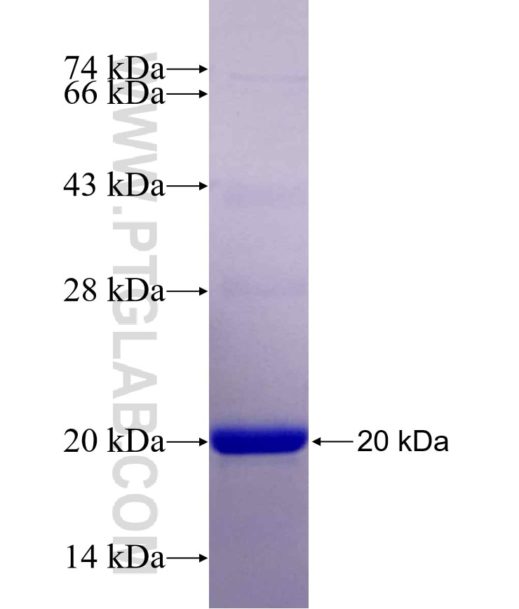 ACSL3 fusion protein Ag29644 SDS-PAGE