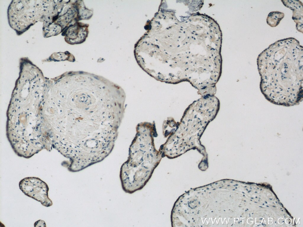 Immunohistochemistry (IHC) staining of human placenta tissue using ACSL4/FACL4 Polyclonal antibody (22401-1-AP)