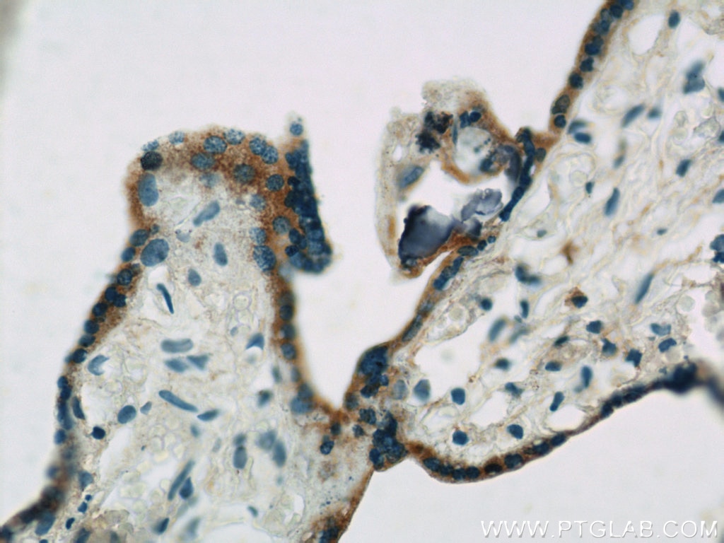 Immunohistochemistry (IHC) staining of human placenta tissue using ACSL4/FACL4 Polyclonal antibody (22401-1-AP)