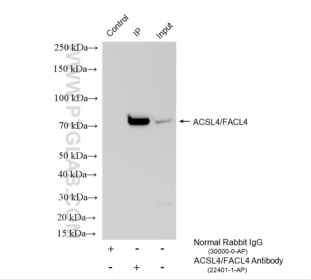 IP experiment of mouse liver using 22401-1-AP Immunoprecipitation (IP) experiment of mouse liver tissue using ACSL4/FACL4 Polyclonal antibody (22401-1-AP)