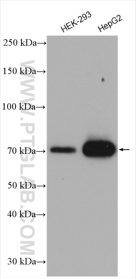 Western Blot (WB) analysis of various lysates using ACSL4/FACL4 Polyclonal antibody (22401-1-AP)
