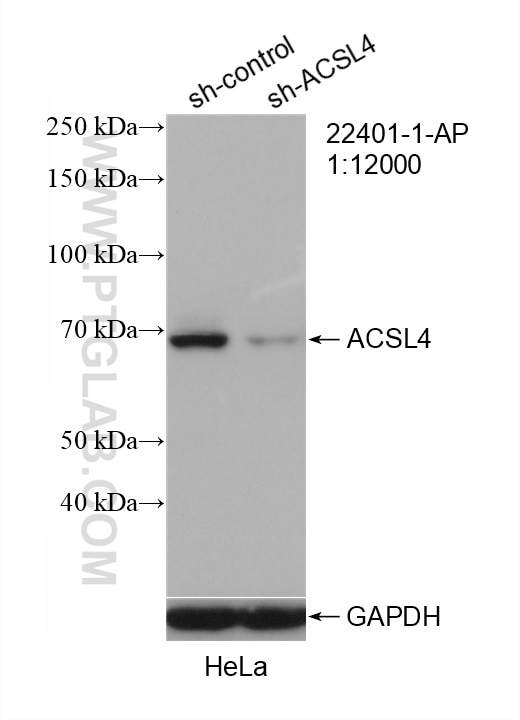 Western Blot (WB) analysis of HeLa cells using ACSL4/FACL4 Polyclonal antibody (22401-1-AP)