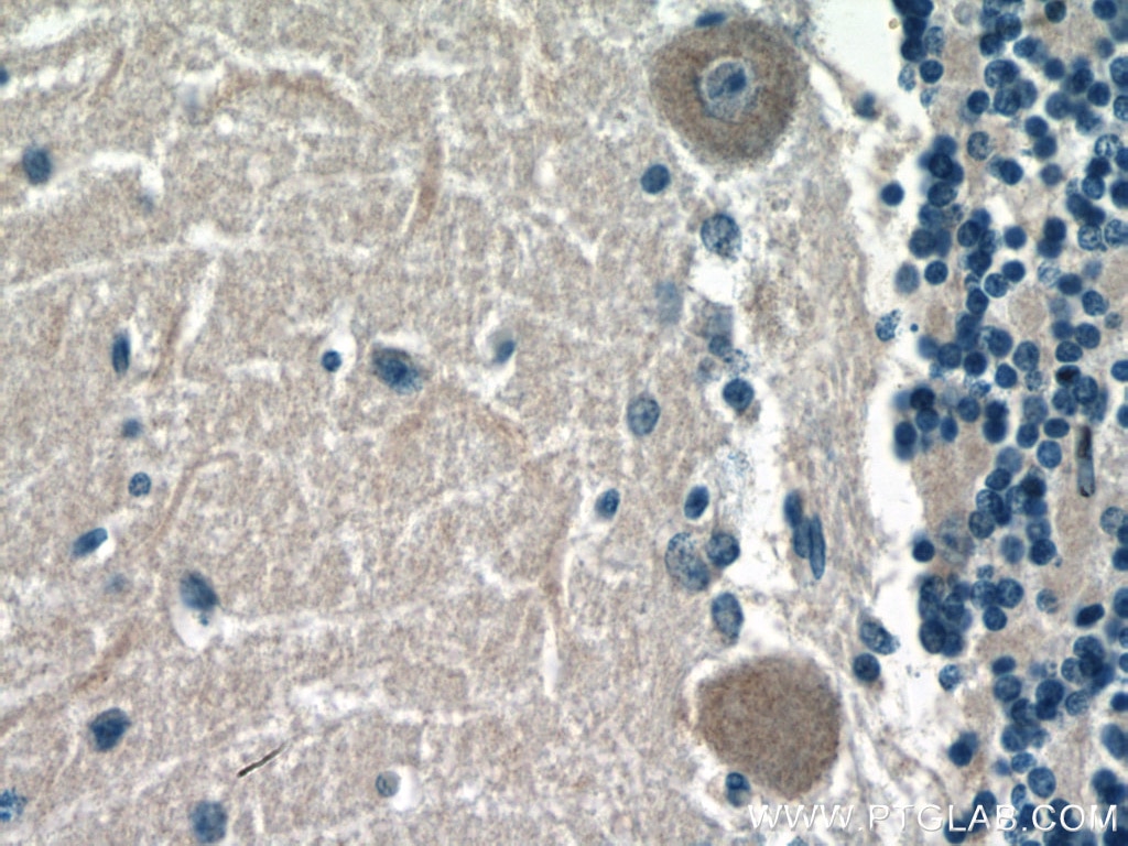 Immunohistochemistry (IHC) staining of human cerebellum tissue using ACSL4 Monoclonal antibody (66617-1-Ig)