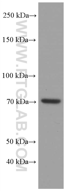 Western Blot (WB) analysis of HeLa cells using ACSL4 Monoclonal antibody (66617-1-Ig)