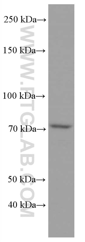 Western Blot (WB) analysis of COLO 320 cells using ACSL4 Monoclonal antibody (66617-1-Ig)