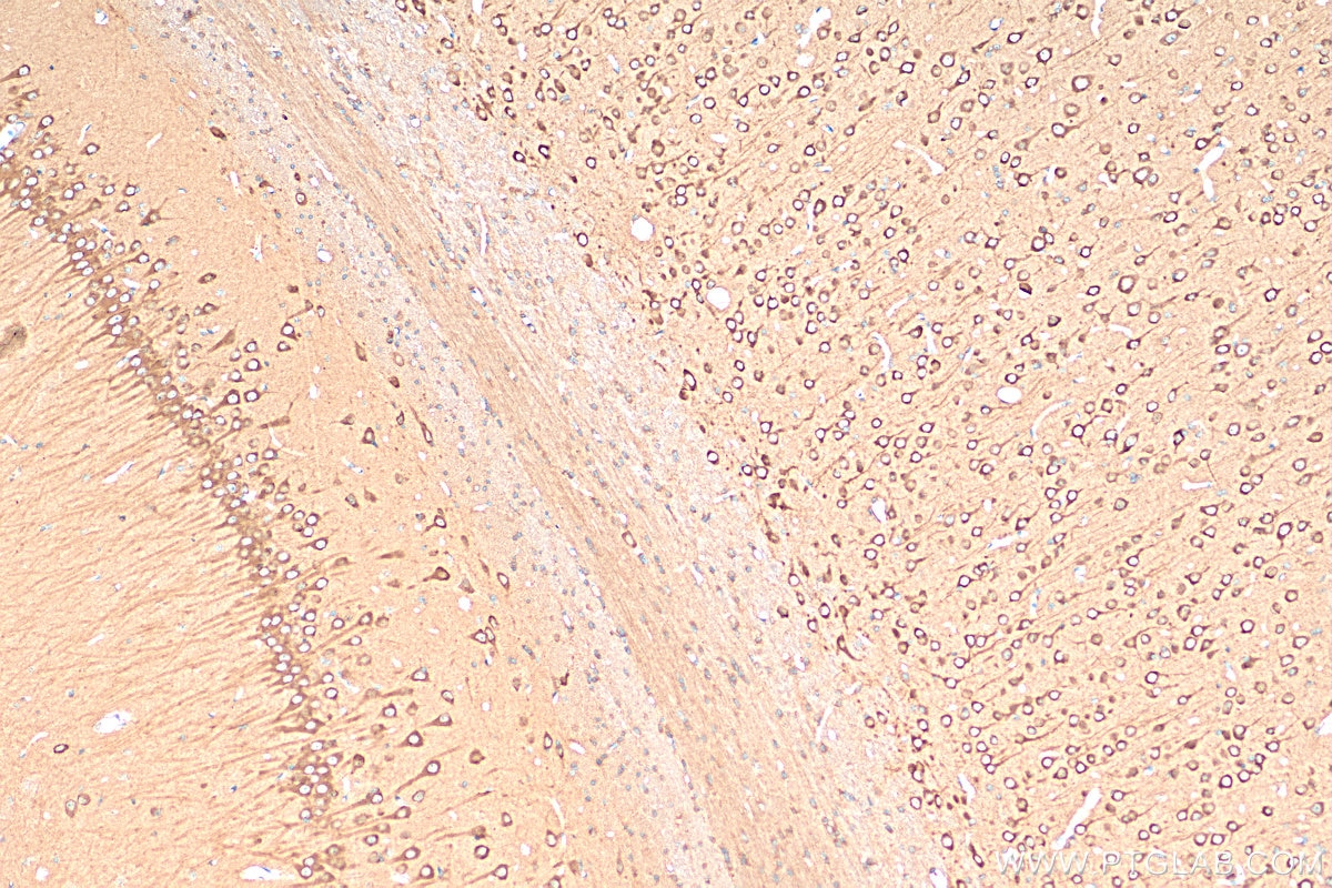 IHC staining of rat brain using 81196-1-RR
