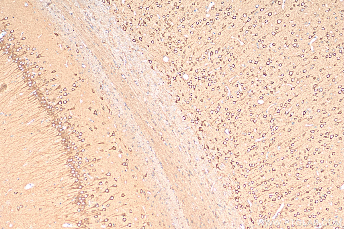 Immunohistochemistry (IHC) staining of rat brain tissue using ACSL4 Recombinant antibody (81196-1-RR)