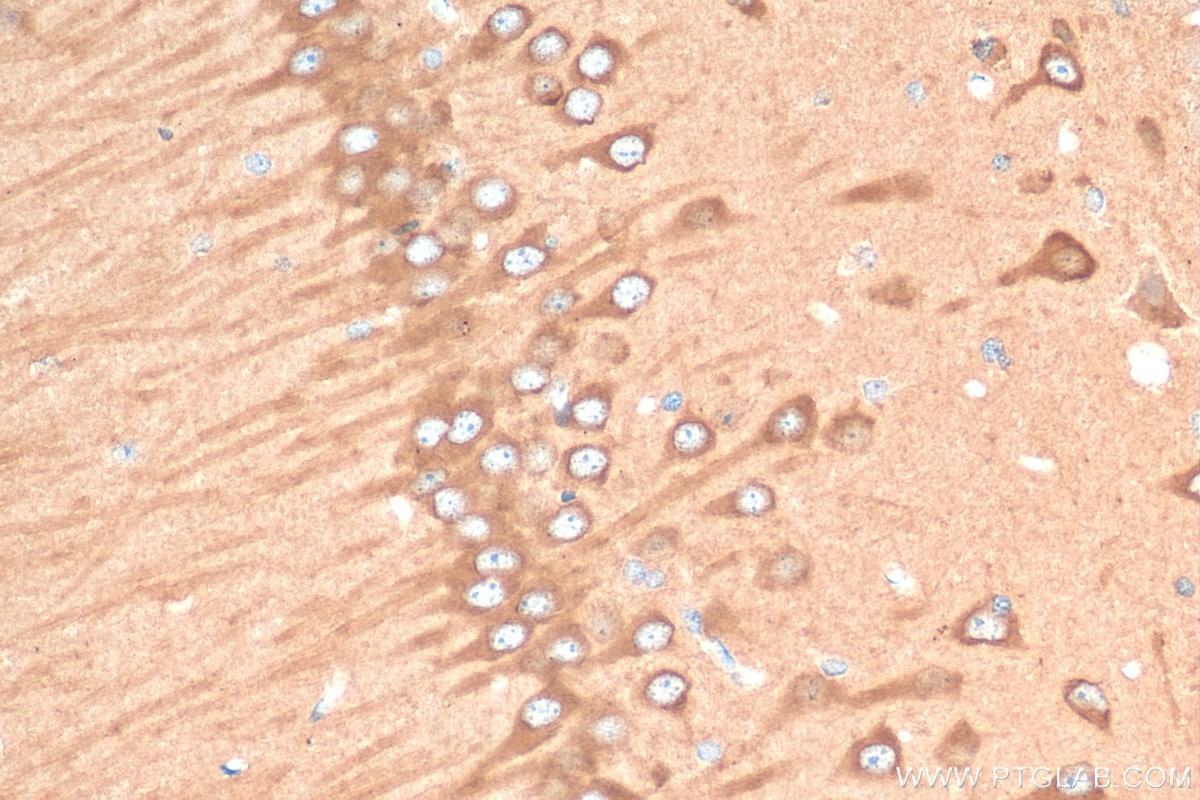 Immunohistochemistry (IHC) staining of rat brain tissue using ACSL4 Recombinant antibody (81196-1-RR)