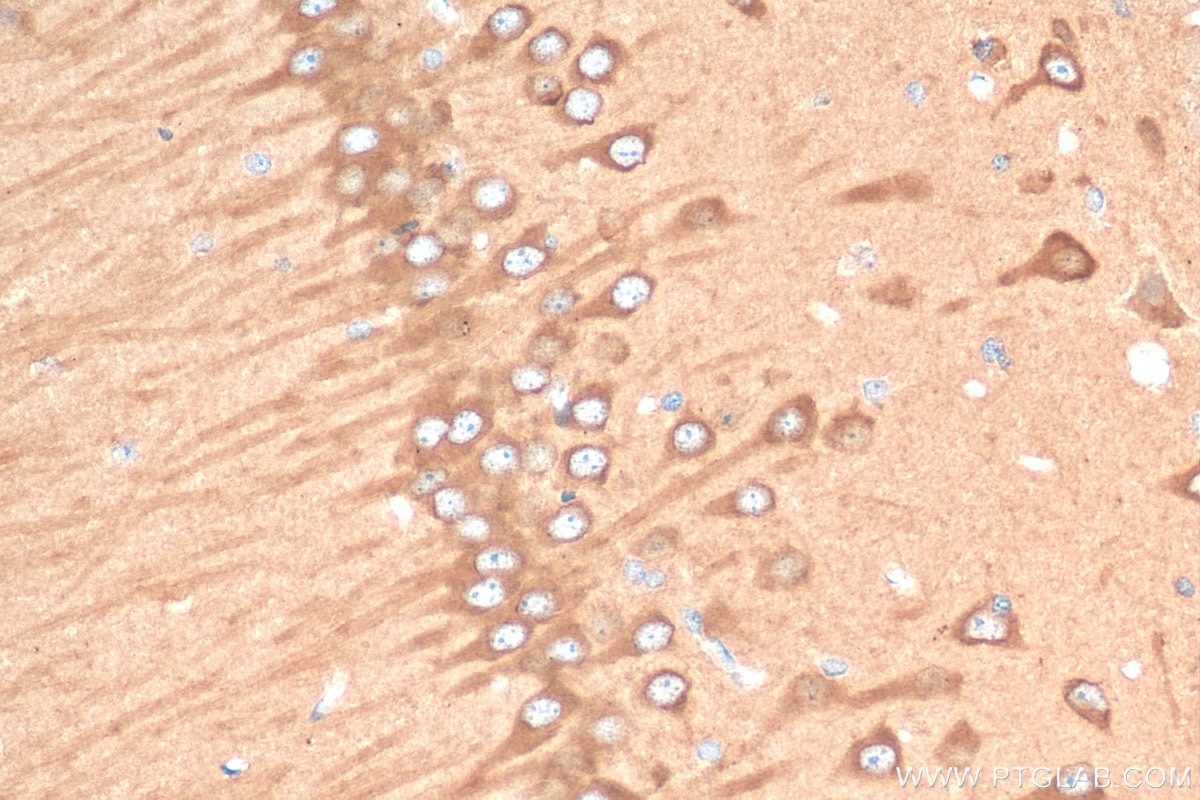 IHC staining of rat brain using 81196-1-RR