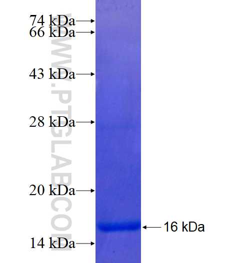 ACSL4 fusion protein Ag18085 SDS-PAGE