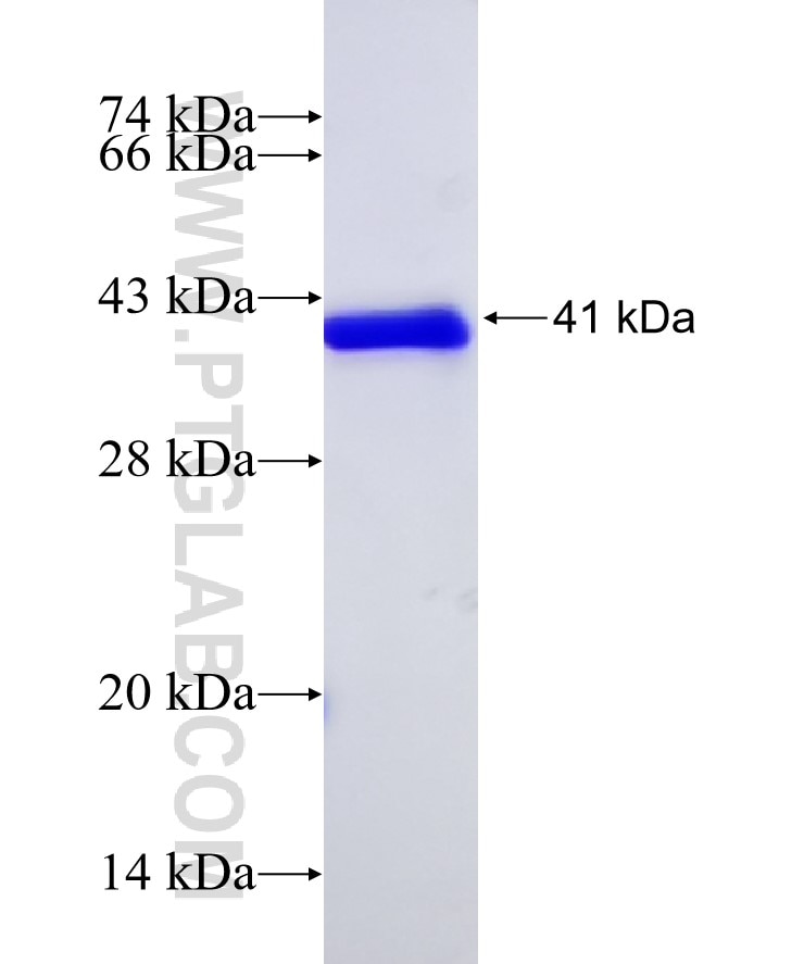 ACSL4 fusion protein Ag18483 SDS-PAGE