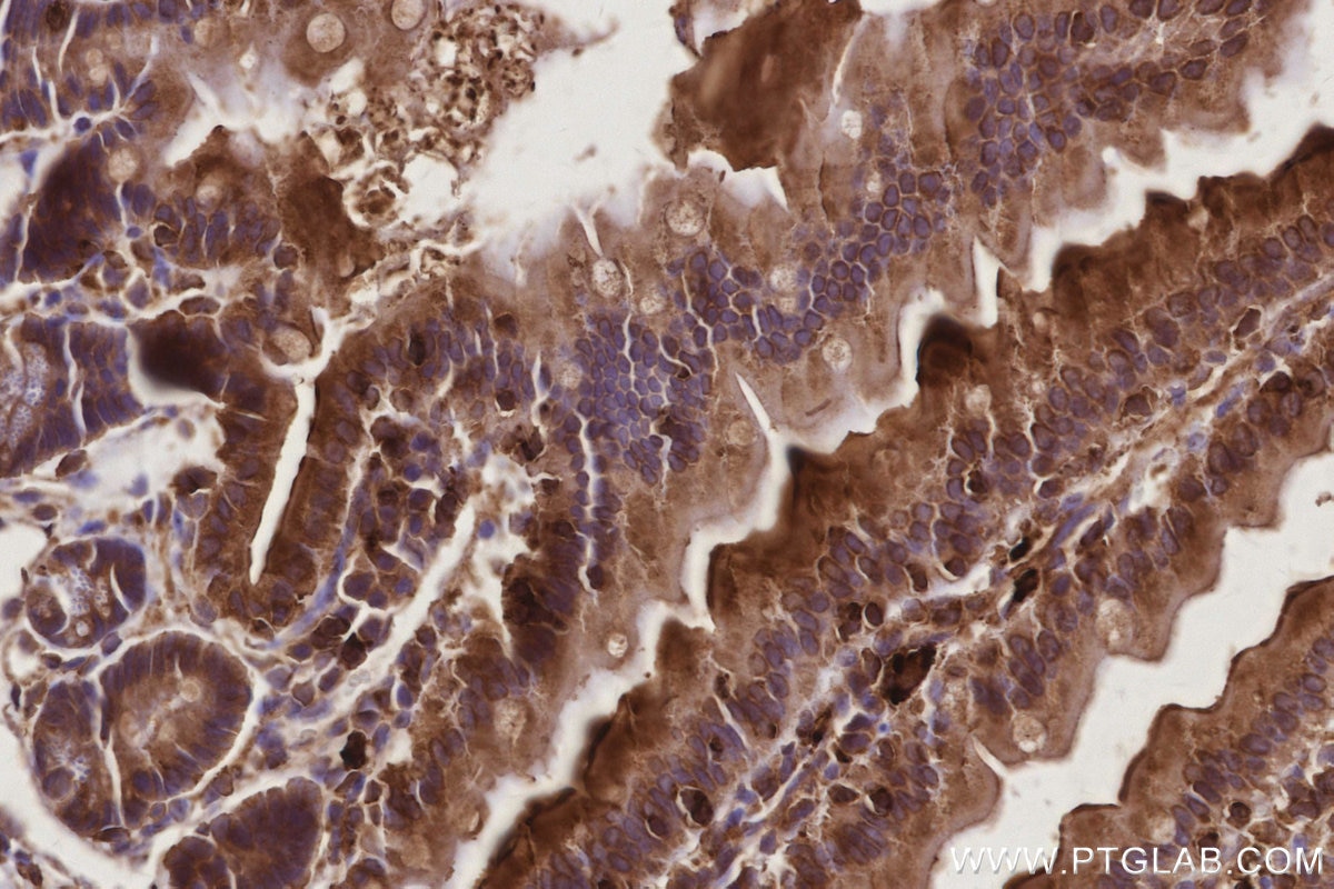 Immunohistochemistry (IHC) staining of mouse small intestine tissue using ACSL5 Polyclonal antibody (15708-1-AP)