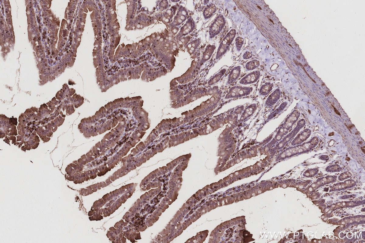 Immunohistochemistry (IHC) staining of rat small intestine tissue using ACSL5 Polyclonal antibody (15708-1-AP)