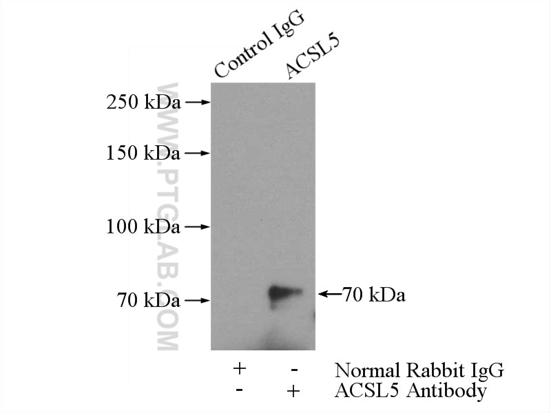 Immunoprecipitation (IP) experiment of mouse brain tissue using ACSL5 Polyclonal antibody (15708-1-AP)