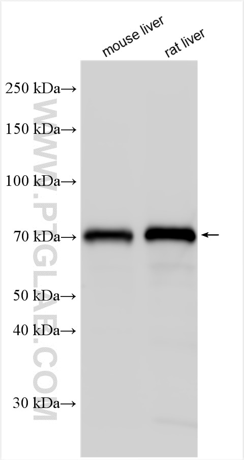 Western Blot (WB) analysis of various lysates using ACSL5 Polyclonal antibody (15708-1-AP)