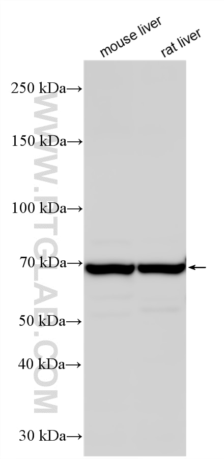 Various lysates were subjected to SDS PAGE followed by western blot with 15708-1-AP (ACSL5 antibody) at dilution of 1:6000 incubated at room temperature for 1.5 hours. Western Blot (WB) analysis of various lysates using ACSL5 Polyclonal antibody (15708-1-AP)