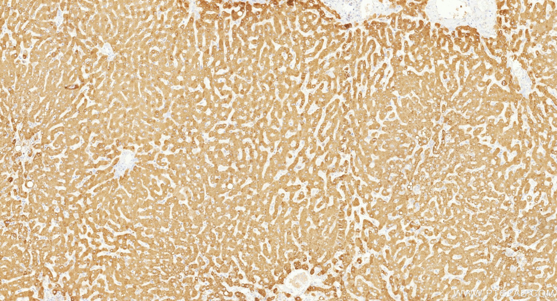 IHC staining of human liver using 86982-1-RR (same clone as 86982-1-PBS) Immunohistochemistry (IHC) staining of human liver tissue using ACSL5 Recombinant monoclonal antibody (86982-1-RR)