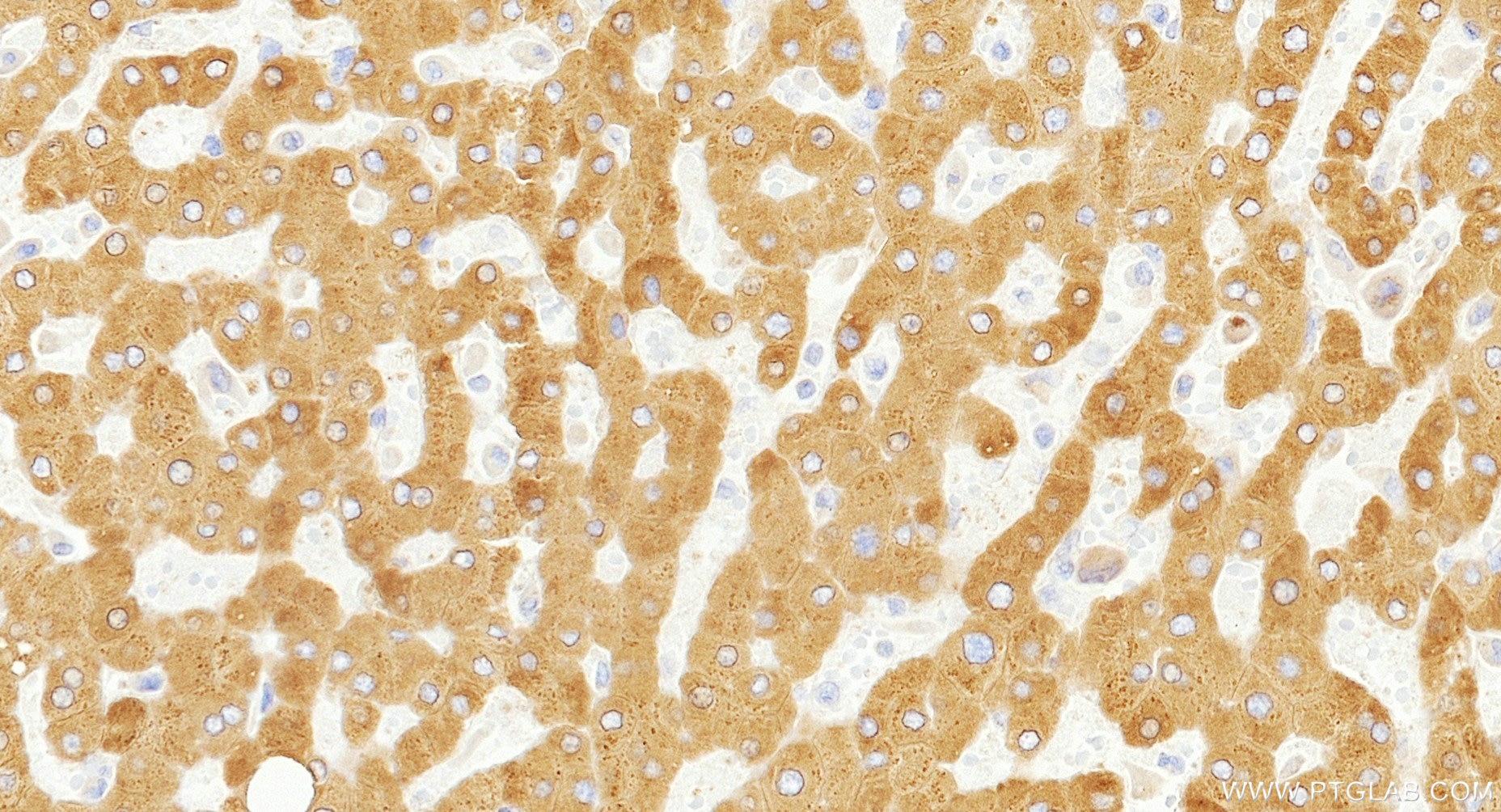 IHC staining of human liver using 86982-1-RR (same clone as 86982-1-PBS) Immunohistochemistry (IHC) staining of human liver tissue using ACSL5 Recombinant monoclonal antibody (86982-1-RR)