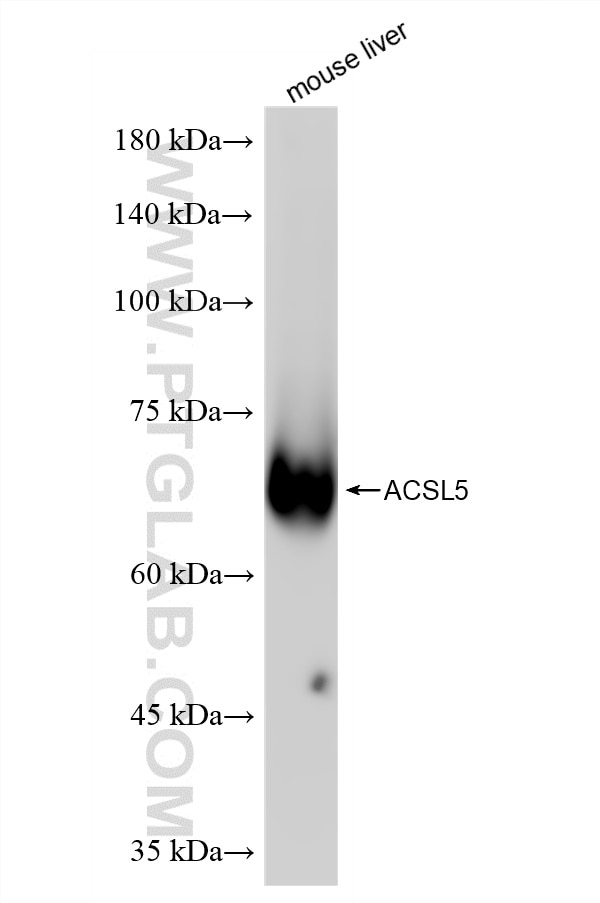mouse liver tissue were subjected to SDS PAGE followed by western blot with 86982-1-RR (ACSL5 antibody) at dilution of 1:10000 incubated at room temperature for 1.5 hours. This data was developed using the same antibody clone with 86982-1-PBS in a different storage buffer formulation. Western Blot (WB) analysis of mouse liver tissue using ACSL5 Recombinant monoclonal antibody (86982-1-RR)