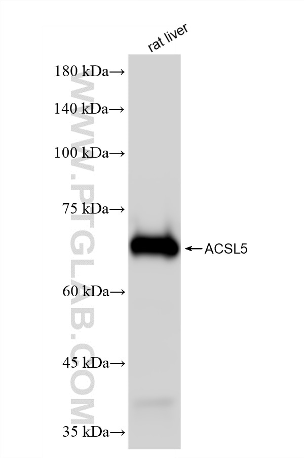 rat liver tissue were subjected to SDS PAGE followed by western blot with 86982-1-RR (ACSL5 antibody) at dilution of 1:10000 incubated at room temperature for 1.5 hours. This data was developed using the same antibody clone with 86982-1-PBS in a different storage buffer formulation. Western Blot (WB) analysis of rat liver tissue using ACSL5 Recombinant monoclonal antibody (86982-1-RR)