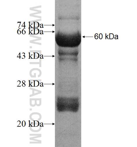ACSL5 fusion protein Ag8258 SDS-PAGE
