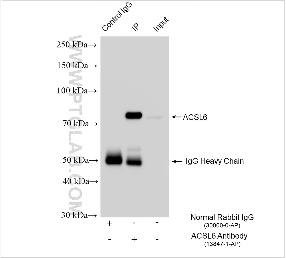 Immunoprecipitation (IP) experiment of mouse brain tissue using ACSL6 Polyclonal antibody (13847-1-AP)