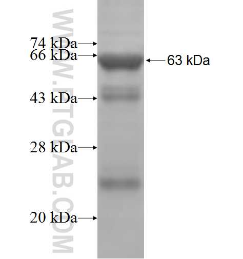 ACSL6 fusion protein Ag4817 SDS-PAGE
