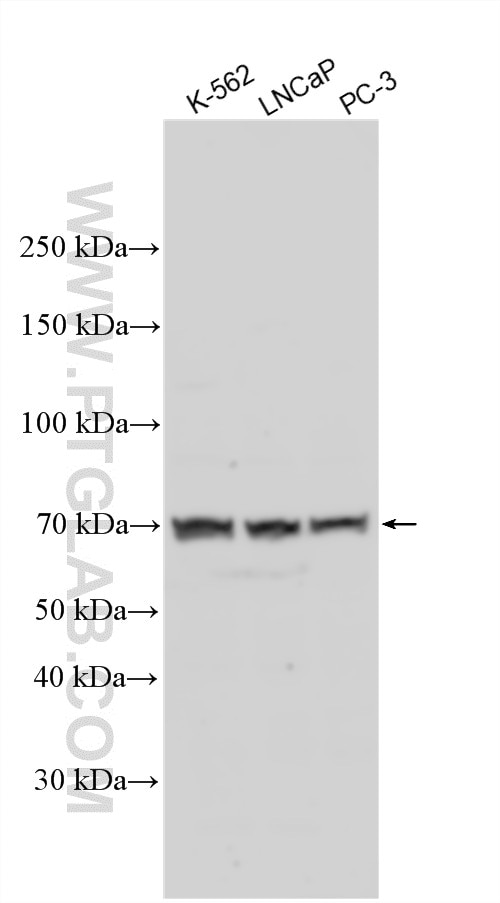 WB analysis using 24407-1-AP Western Blot (WB) analysis of various lysates using ACSM1 Polyclonal antibody (24407-1-AP)
