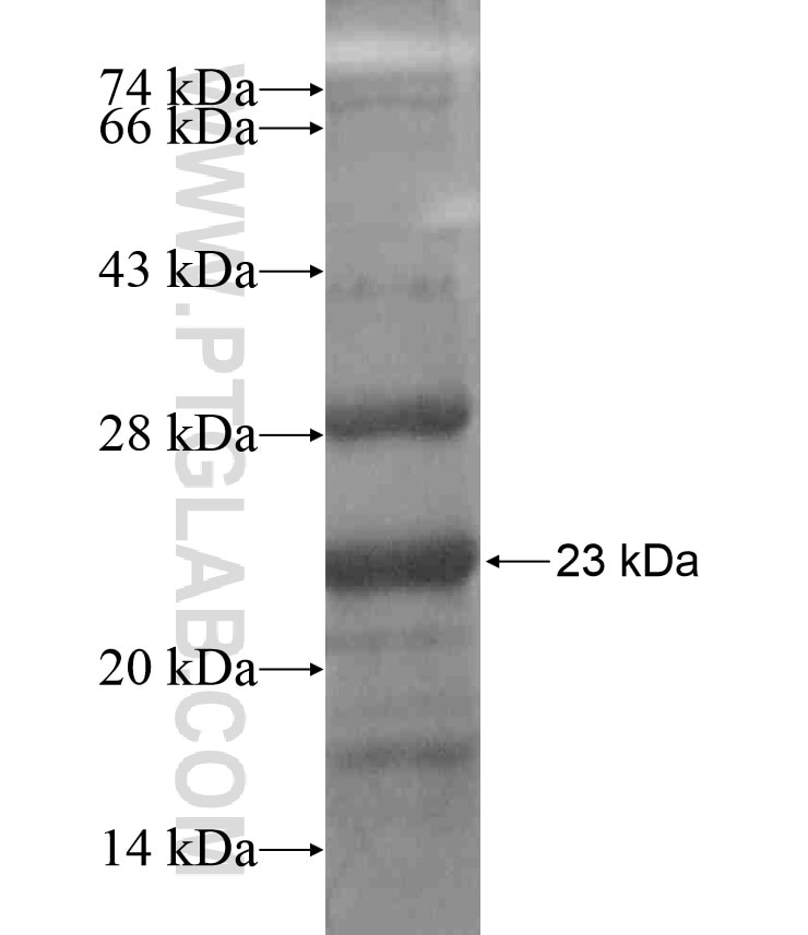 ACSM1 fusion protein Ag18475 SDS-PAGE