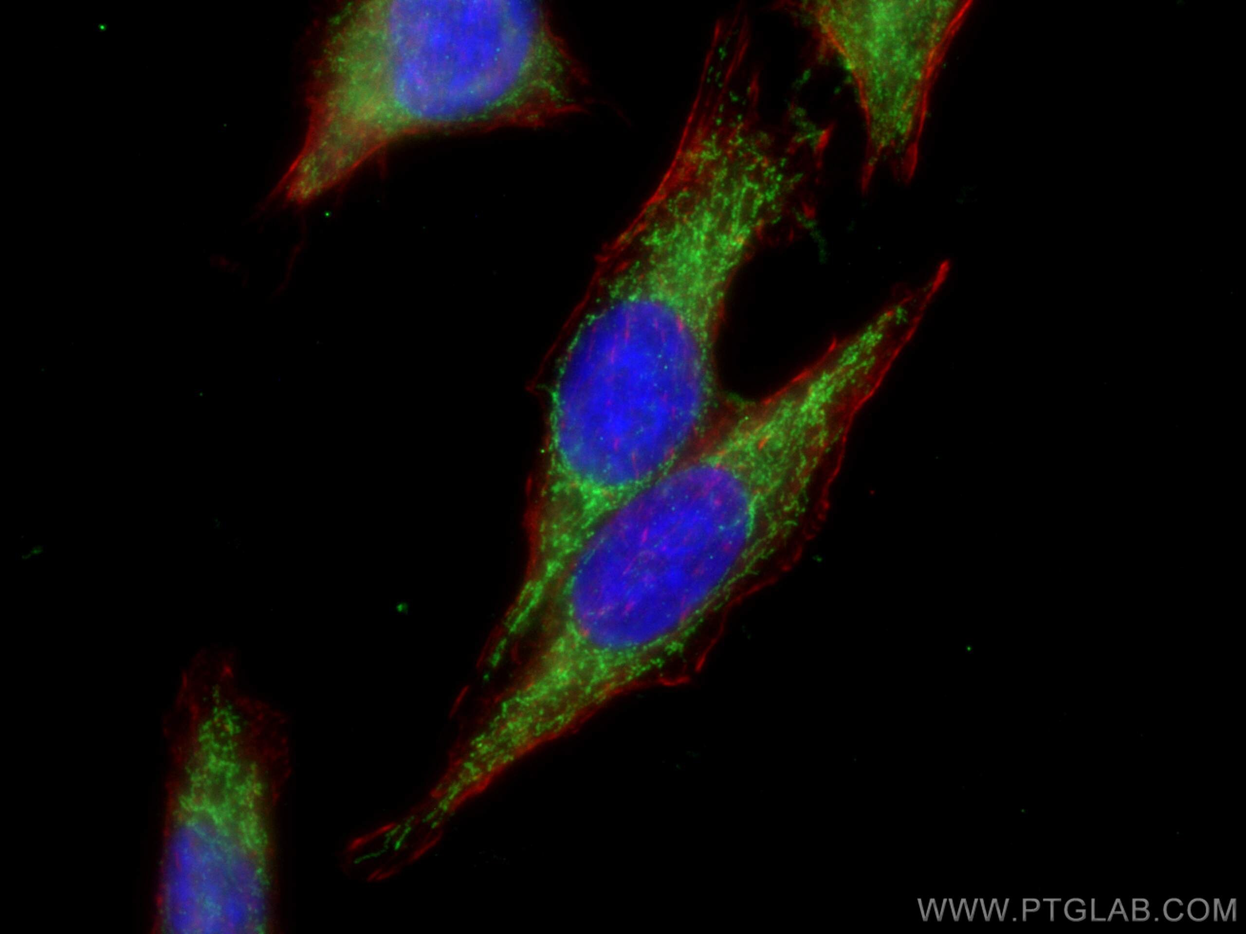 Immunofluorescence (IF) / fluorescent staining of HepG2 cells using ACSM2A Polyclonal antibody (22862-1-AP)
