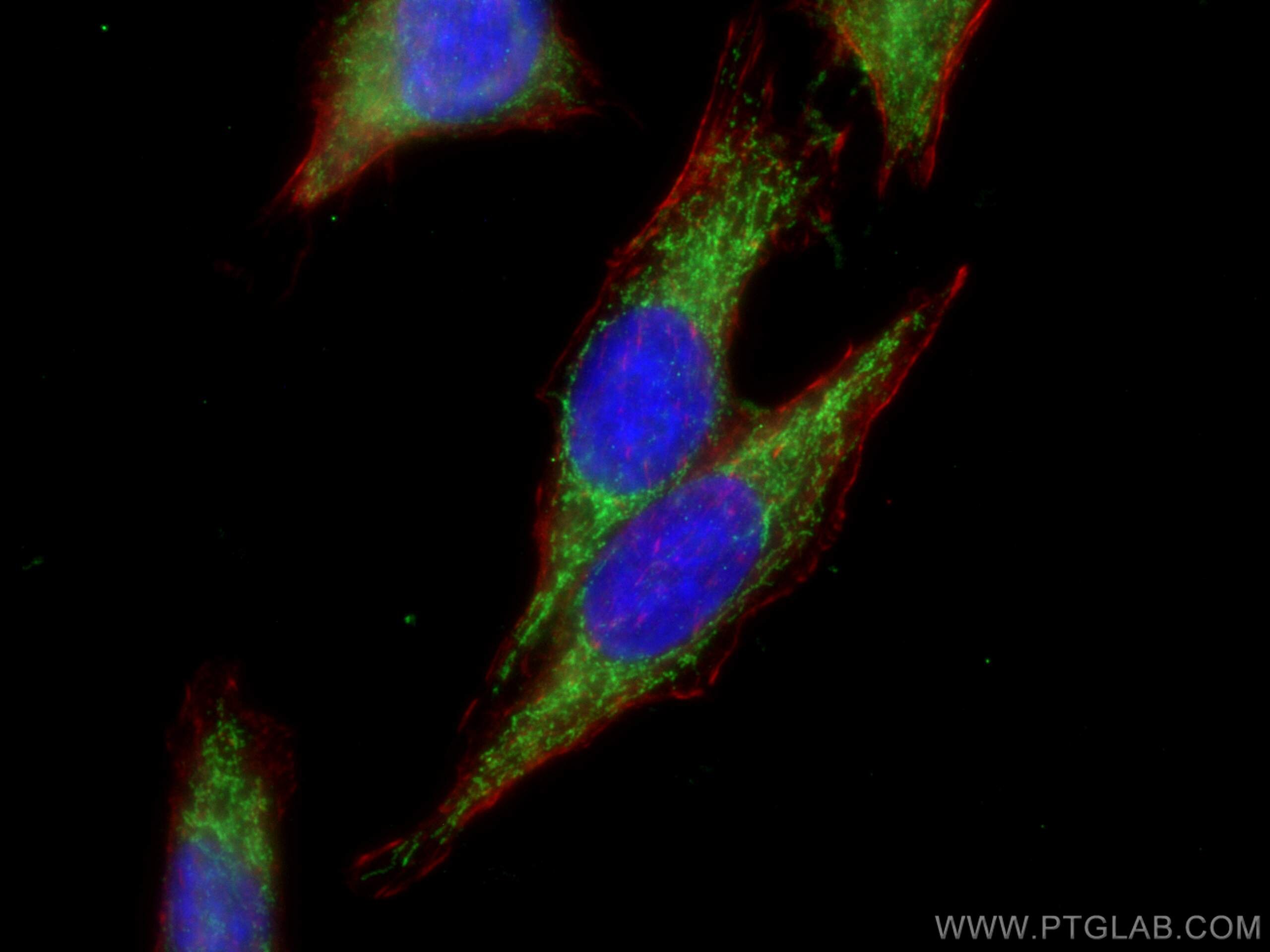 IF Staining of HepG2 using 22862-1-AP