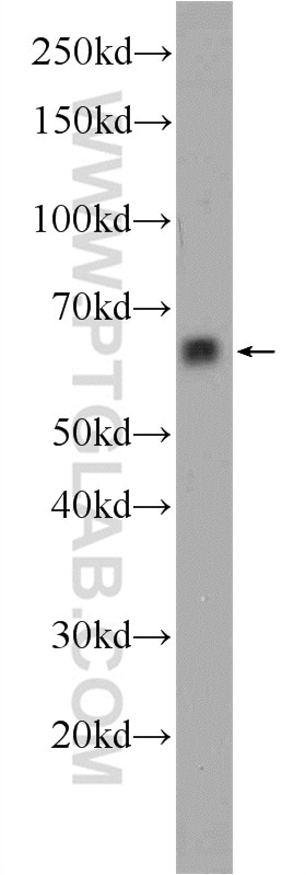 Western Blot (WB) analysis of human brain tissue using ACSM2A Polyclonal antibody (22862-1-AP)