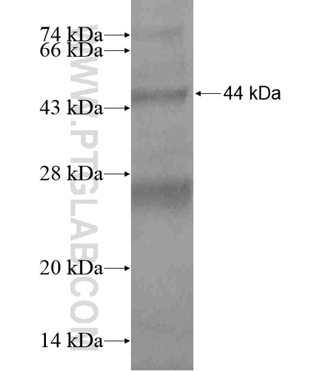 ACSM2A fusion protein Ag18856 SDS-PAGE