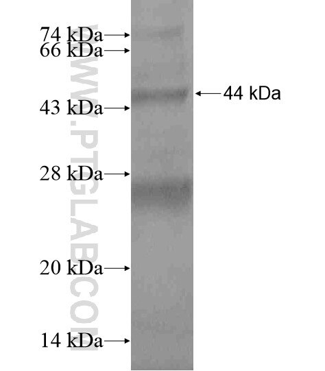 ACSM2A fusion protein Ag18856 SDS-PAGE