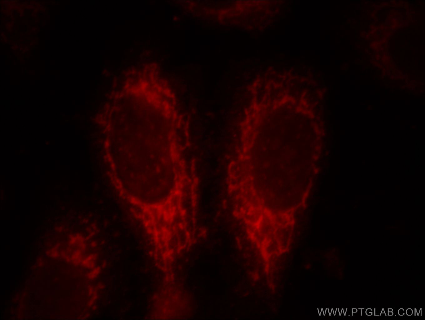 Immunofluorescence (IF) / fluorescent staining of HepG2 cells using ACSM3 Polyclonal antibody (10168-2-AP)