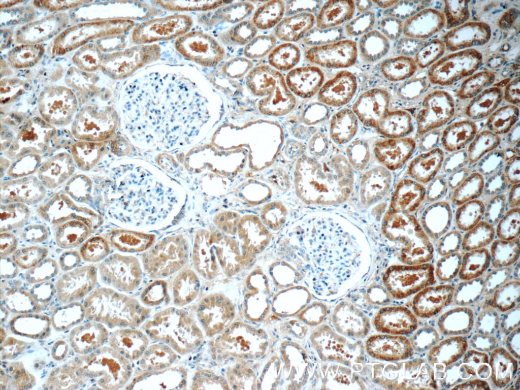 Immunohistochemistry (IHC) staining of human kidney tissue using ACSM3 Polyclonal antibody (10168-2-AP)
