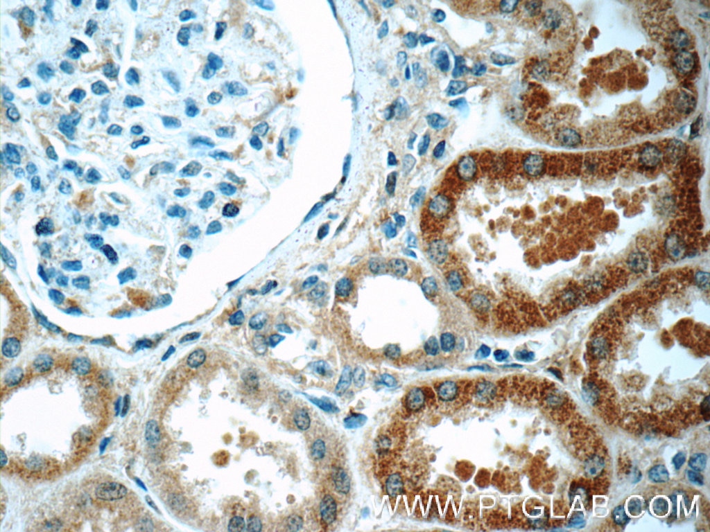 Immunohistochemistry (IHC) staining of human kidney tissue using ACSM3 Polyclonal antibody (10168-2-AP)